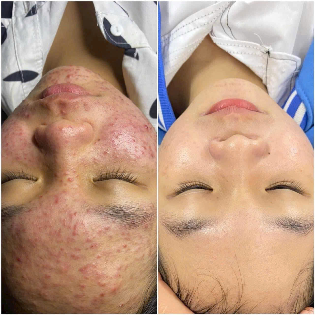 điều trị chăm sóc da chuyên sâu