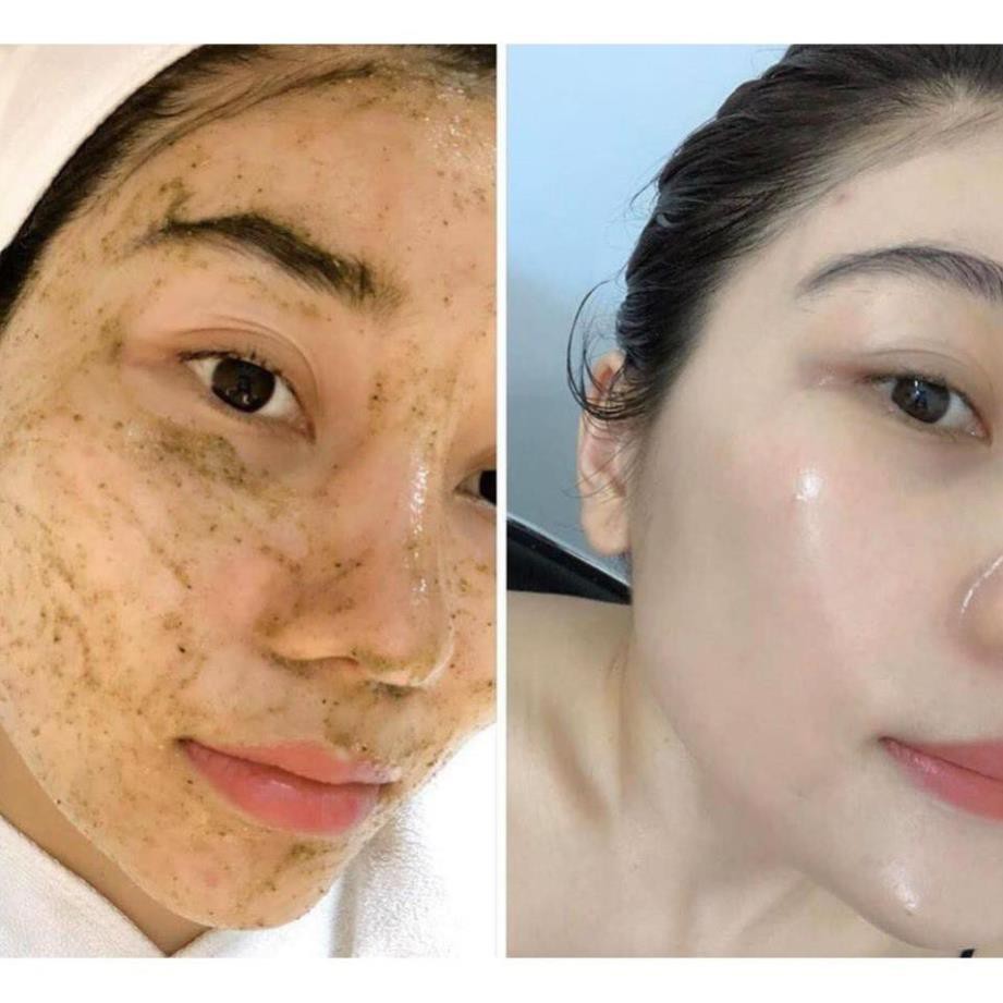 Địa chỉ peel da uy tín
