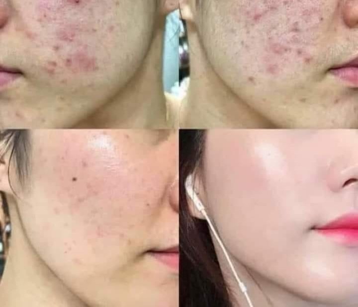 Viện điều trị chăm sóc da chuyên sâu tại TPHCM
