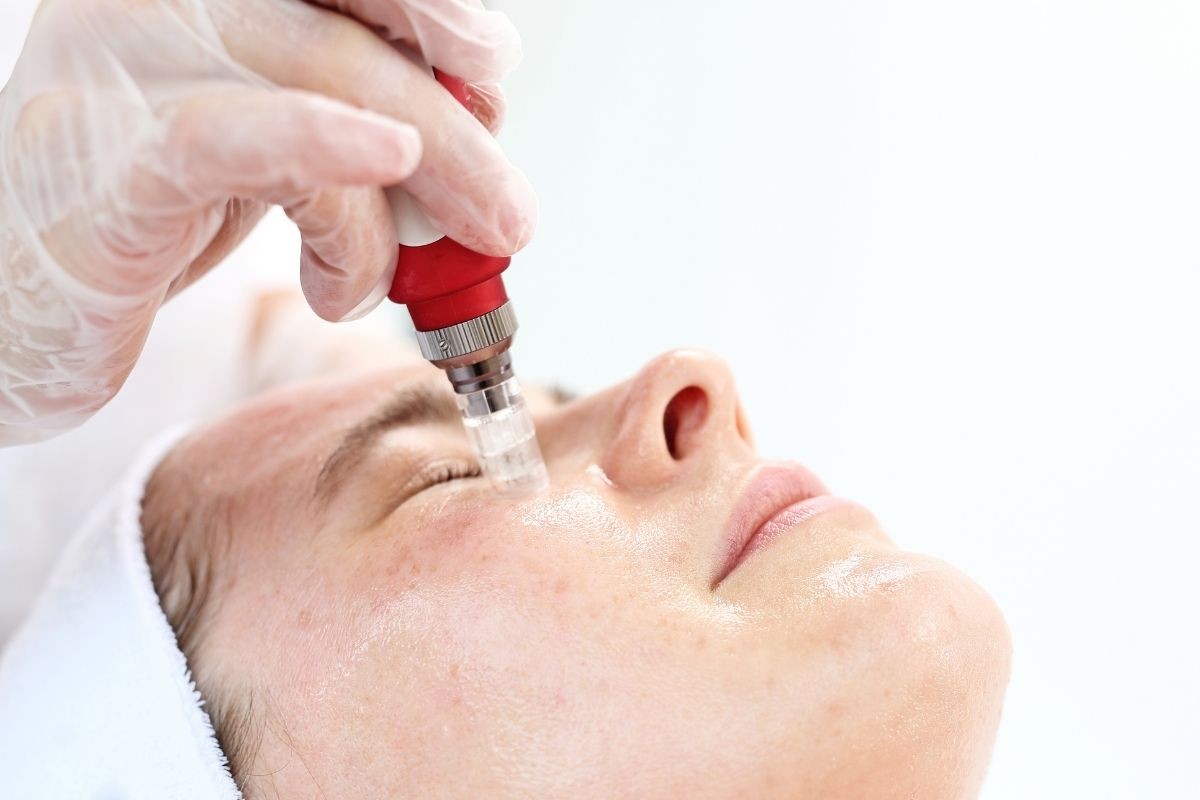 Phi kim trị thâm nám hiệu quả tại TPHCM