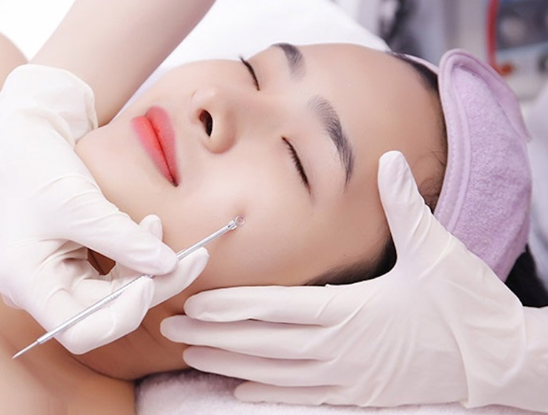 Điều trị da chuyên sâu giảm mụn thâm tại TPHCM