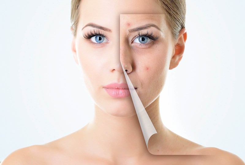 Dịch vụ nặn mụn chuẩn y khoa uy tín