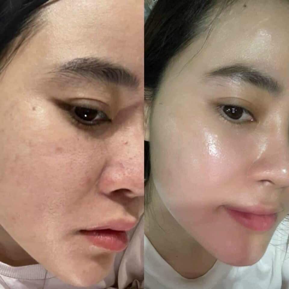 Địa chỉ peel da uy tín
