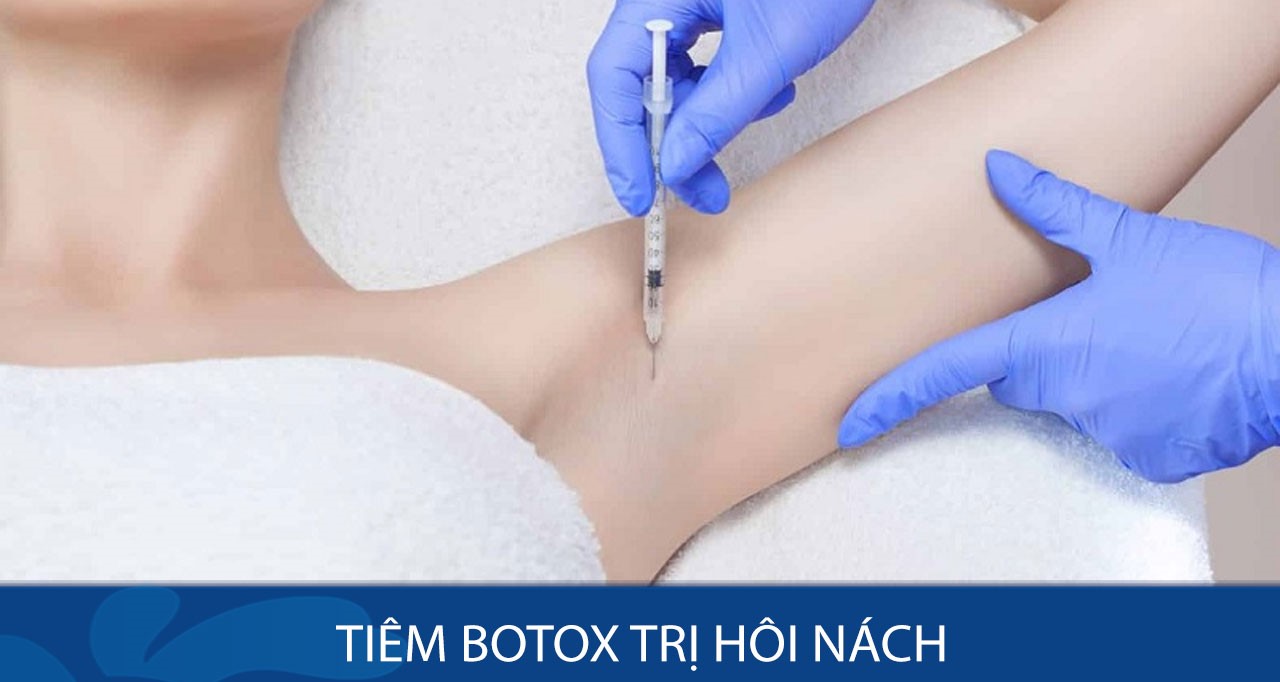 Trị tuyến mồ hôi