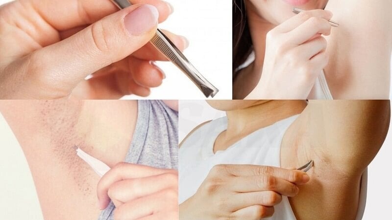 triệt lông nách giá rẻ