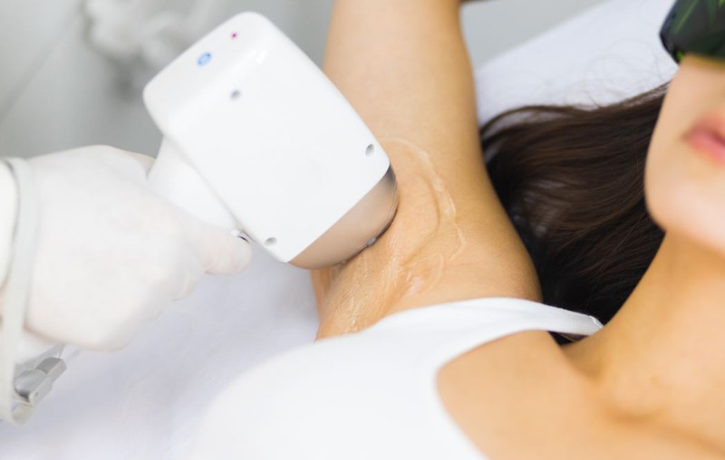Triệt lông nách giá rẻ tại Gò Vấp
